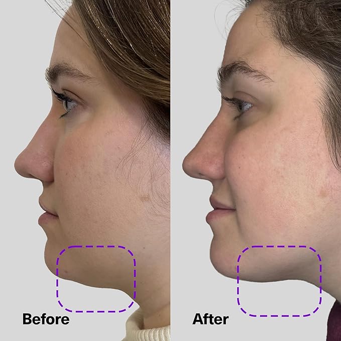 SickScience ShapeShift Exosome V-Line Jaw & Neck Firming & Tightening Serum