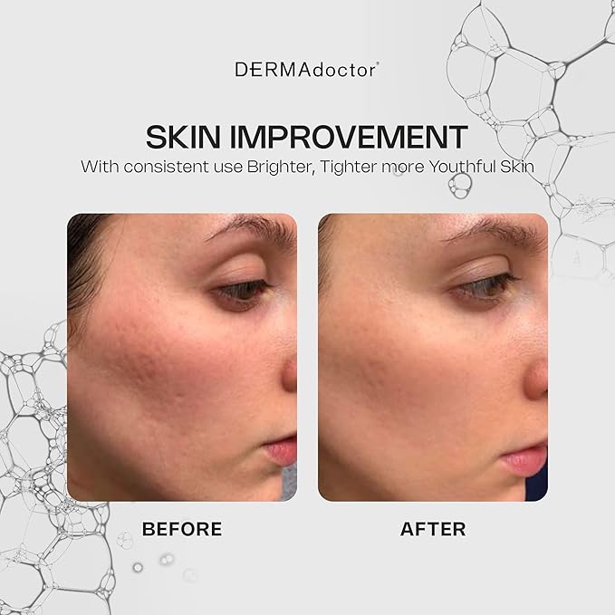 DERMAdoctor Kakadu C 20% Vitamin C Serum for Face, Ferulic Acid, 1 fl oz