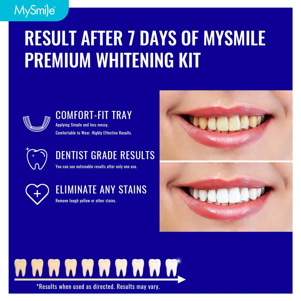 MySmile 7 Treatments Prefilled Teeth Whitening Trays Kit with 12% Hydrogen Peroxide Whiter Gel for Sensitive Tooth, Fast-Result Vegan Teeth Whitener U-Wraps Tooth Stain Remover, Mint Flavor