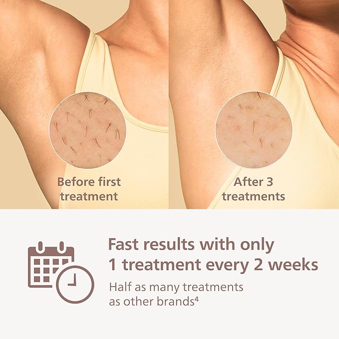 Philips Lumea IPL — Salon-Like Laser Hair Removal for Women, Permanent Hair Reduction Device At Home for Face & Body — Safe & Painless for Face, Bikini, Body, 5 Settings & Skin Sensors, BRI984/03