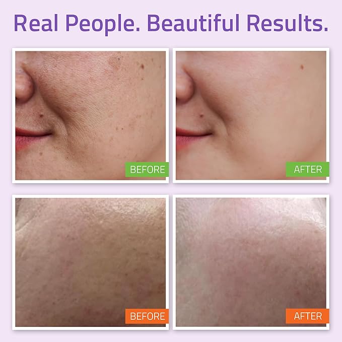 YEOUTH Skin Care Set 6-Piece Full Size for Radiant-Looking Skin