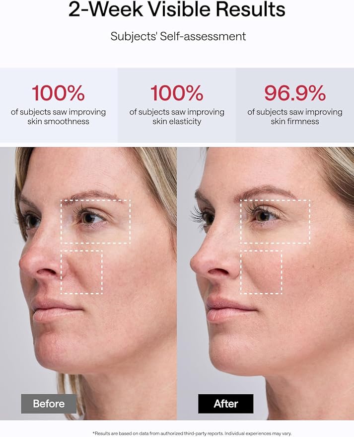 JMOON by Ulike Microcurrent Facial Device, M30U Red Light Therapy for Face, Safe Anti Aging Skin Care, 4 Modes, 5 Energy Levels for Full Face Lift and Ideal for Smile Lines, Eyes, and Forehead (Pink)