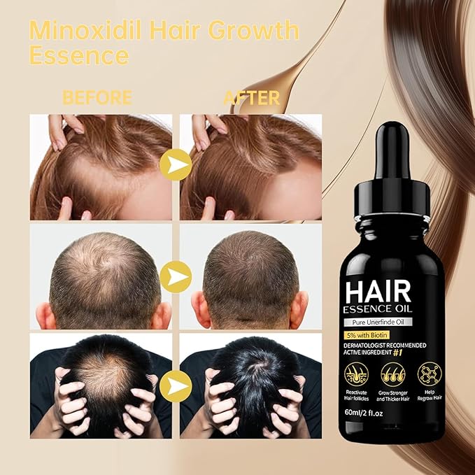 5% Minoxidil Natural Hair Oil with Biotin for Men and Women, 2 Fl Oz (60ml)