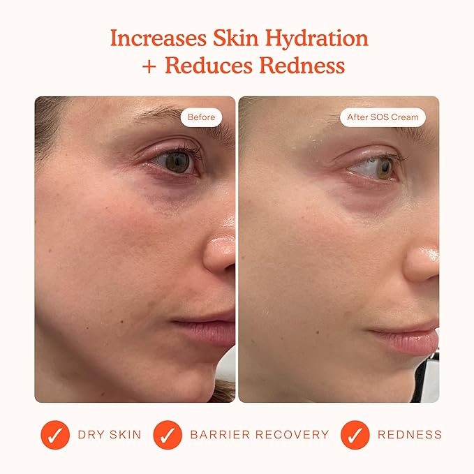 Tower 28 SOS Recovery Hydrating Face Cream for Sensitive Skin (1.86 oz)