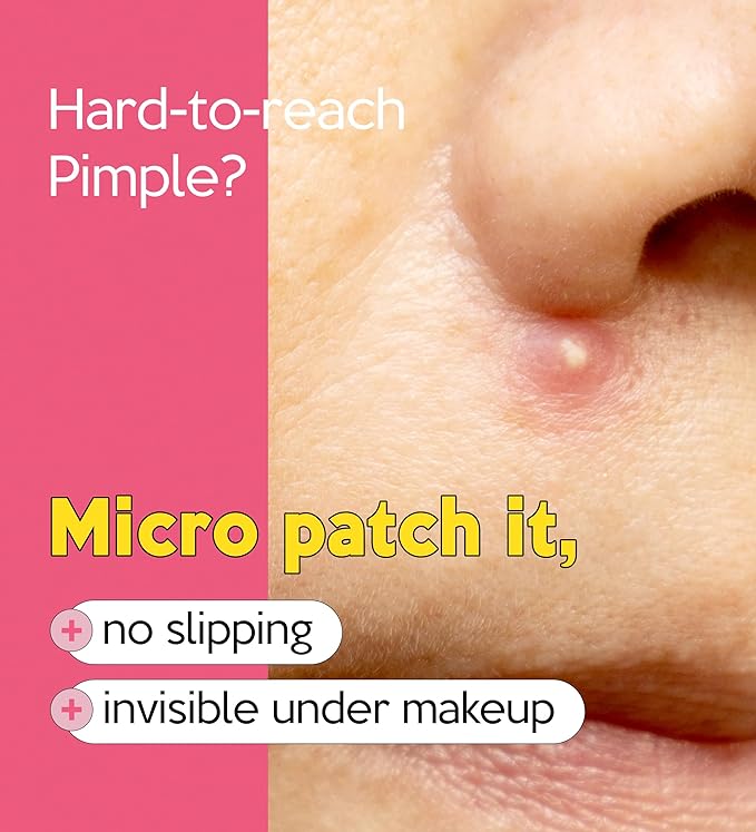Troubless Invisible Plus Spot Patch - Hydrocolloid (0.8cm & 1cm, 123 EA)
