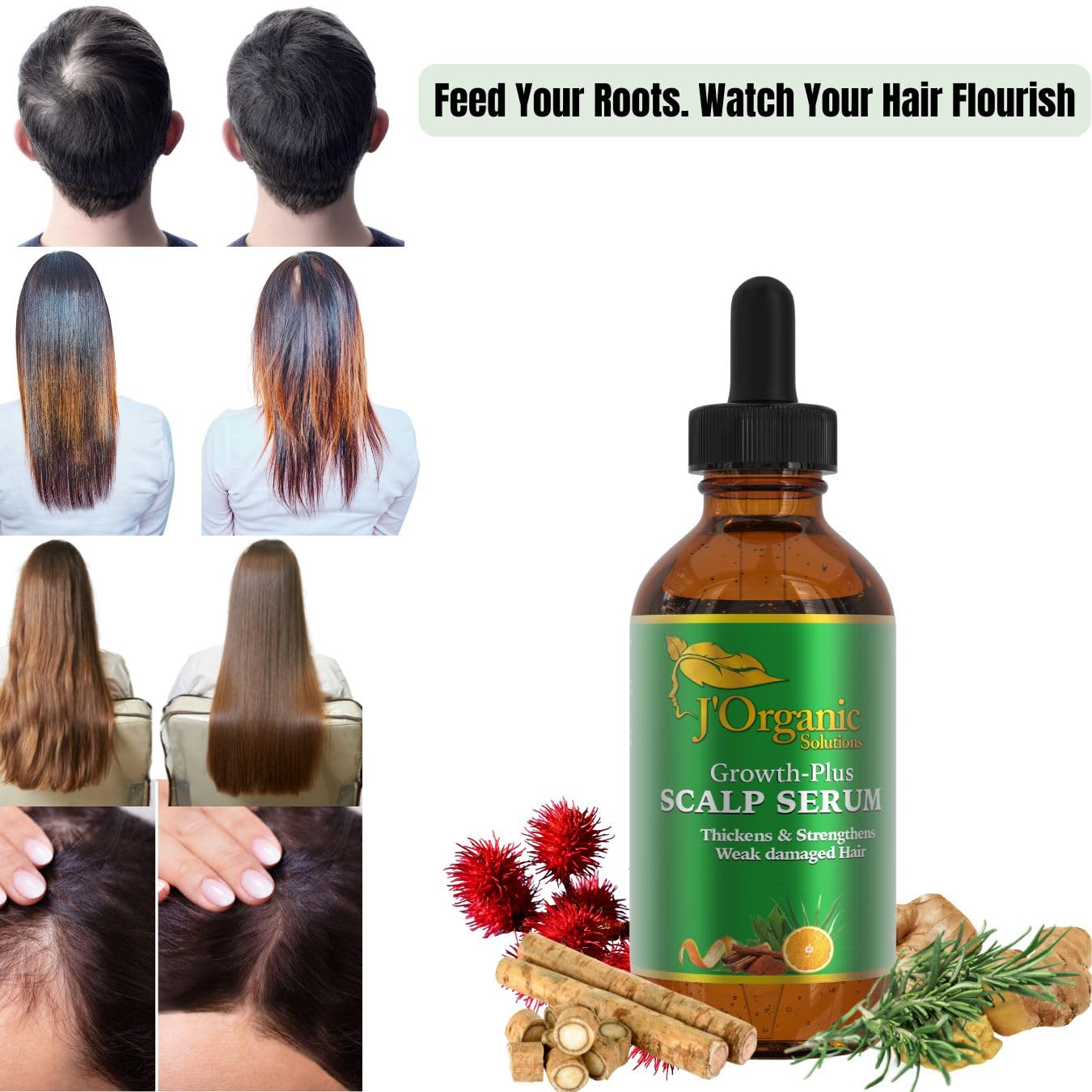 J'Organic Solutions Growth-Plus Scalp Nourishing Oil (4 Oz)
