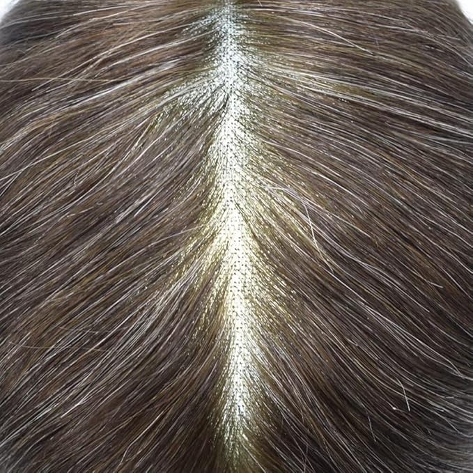 F M FACE MIRACLE NEW YORK Toupee for Men French Lace Center Mens Toupee Hairpiens Human Hair Replacement System Black Brown Blonde Gray Hair Units, 7X9