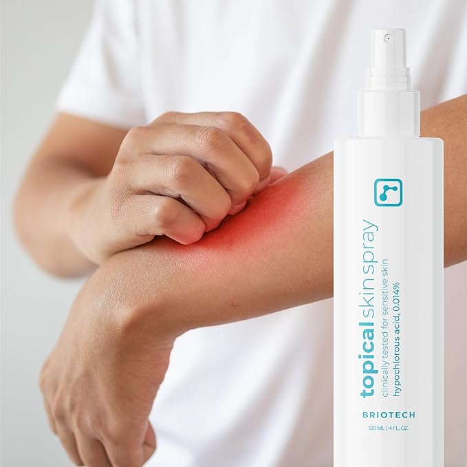 BRIOTECH Topical Skin Spray, Hypochlorous Acid Spray for Sensitive Skin, HOCl Facial Mist, Full Body Support Against Irritation, Calm Redness, Soothe Foot & Scalp, 8.5 oz (1 Pack)
