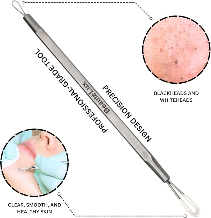 BeautéLux 2-in-1 Blackhead Removal Tool, Stainless Steel Acne Extractor, Blackhead & Whitehead Remover for Face/Nose, Dual-Loop Pimple Extractor, Skin Blemish Tool