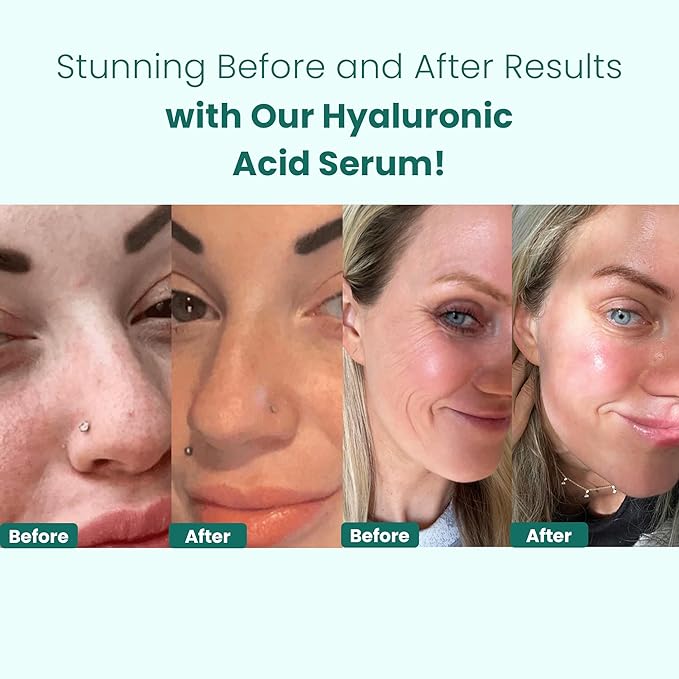 Gin Amber Beauty Vitamin C, Hyaluronic, Peptide & Niacinamide Serums 4 Pack