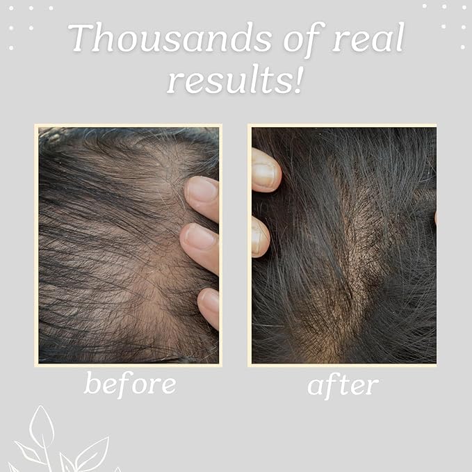 START NATURALS Batana Oil for Hair Strength, 100% Pure & Natural from Honduras, Promotes Hair Wellness for Men & Women