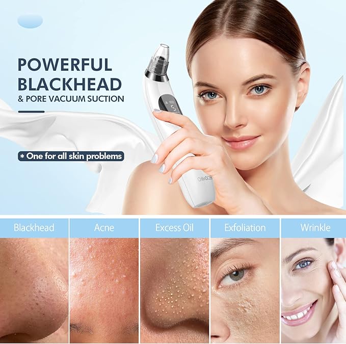 CHIMOCEE Blackhead Remover Pore Vacuum, Upgraded Black Head Remover for Face, Electric Acne Comedone Whitehead Extractor Tools-5 Suction Power, 5 Probes, USB Rechargeable Pimple Popper Tool Kit