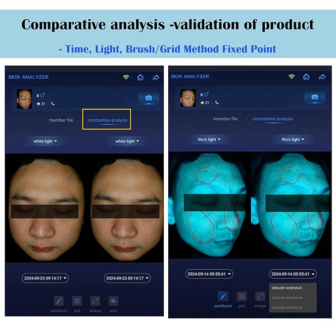 NETTITO 15.6" Professional Skin Analysis Device for Beauty Salons & Spas – AI-Powered 7-Spectral Imaging, 17 Skin Indicators, Multi-Language & Cloud Report Storage