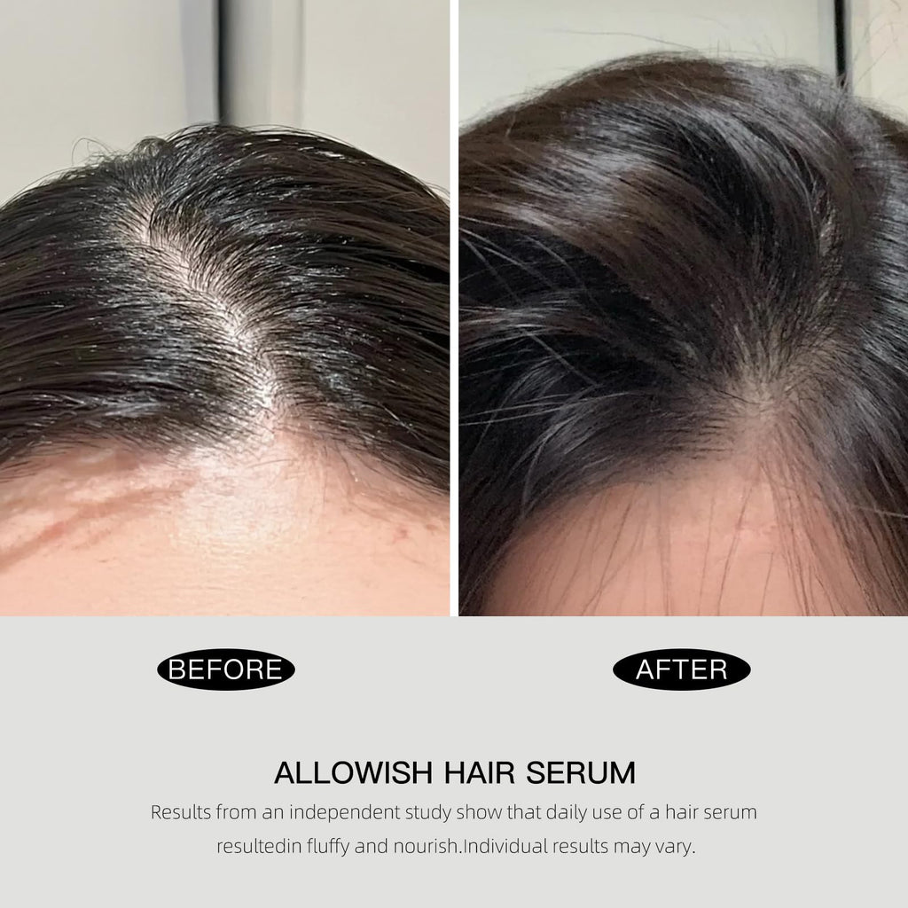ALLOWISH Advanced Hair Serum - 95 ml Scalp Treatment for Fuller, Nourish, Glossy Hair | Prevents Frizz, Promotes Healthy Scalp & Strengthens Roots, Reduces Oil & Buildup