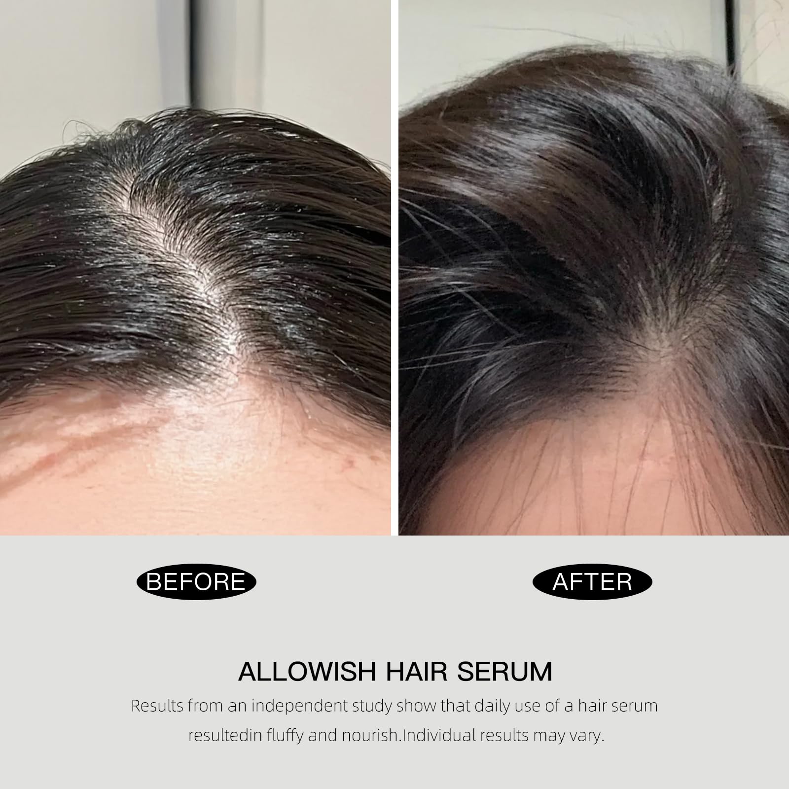 ALLOWISH Advanced Hair Serum - 95 ml Scalp Treatment for Fuller, Nourish, Glossy Hair | Prevents Frizz, Promotes Healthy Scalp & Strengthens Roots, Reduces Oil & Buildup
