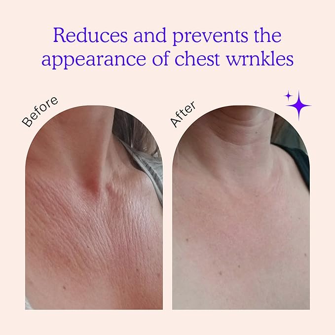 BLUMBODY Chest, Neck Wrinkle Pads – Anti-Wrinkle Silicone Patches Skin Firming, Smoothing – Reusable Overnight Pad – Anti-Aging Crepe Erase Pads – Neck, Décolleté (1-Month Supply)