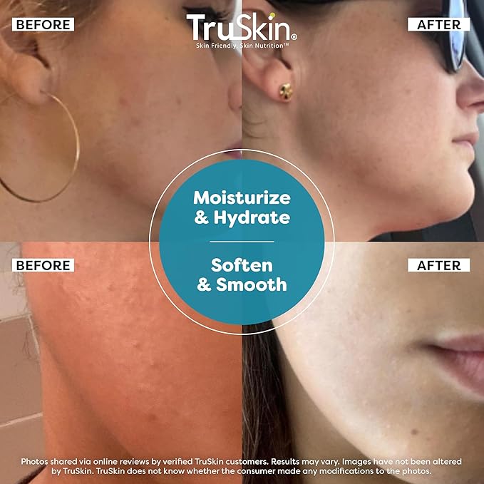 TruSkin Hyaluronic Acid Serum for Face for Hydrated, Plumper Skin, 1 fl oz