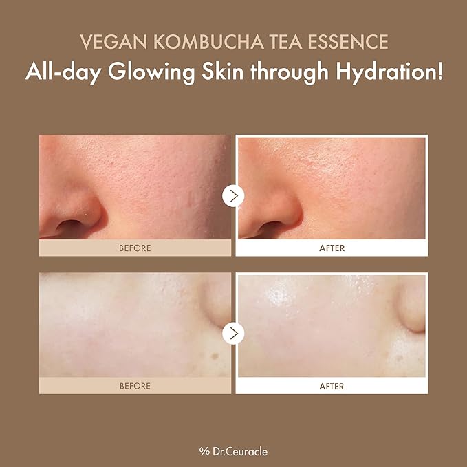 Dr.Ceuracle Vegan Kombucha Tea Essence, Hydrating Milky Toner 5.07 fl. oz.
