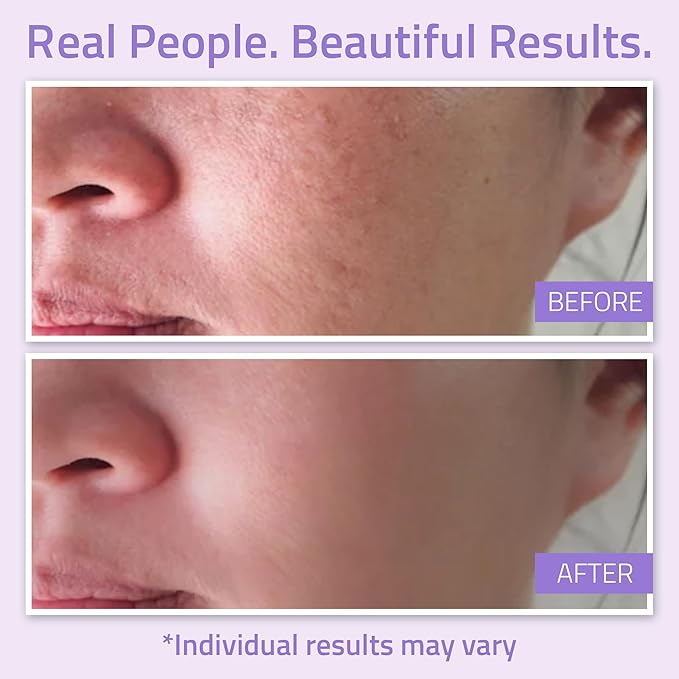 YEOUTH Balancing Alcohol Free Toner for Calm and Refreshed-Looking Skin