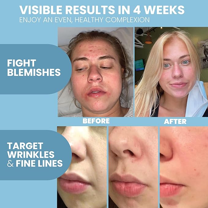 Retinol Serum for Face with Hyaluronic Moisture Complex Lightweight Night Serum for Smoother, Radiant-Looking Skin | Helps Minimize the Appearance of Fine Lines & Uneven Tone 2 oz 2 Pack