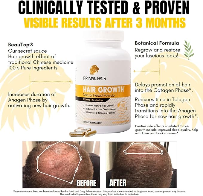Primal Hair 3 PK- 100% Natural Growth Treatment, Reduces Hair Loss, US Patented Formula Proven Effective for Men & Women, 100% Vegan, Non-GMO, 90-Day Supply, 3 Pack
