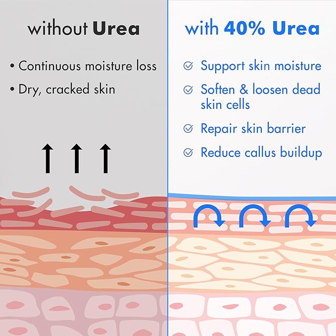 Ebanel Urea Cream 40% plus Salicylic Acid 2% for Dry Cracked Feet Skin