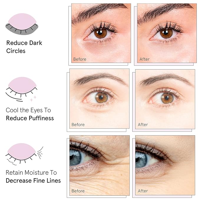 grace & stella Award Winning Under Eye Mask - Birthday Gifts for Women - Gel Eye Patches for Dark Circles, Puffy Eyes, Undereye Bags - Gifts for Mom - Vegan Self Care (24 Pairs, Gold)