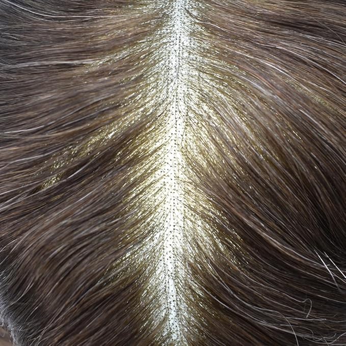 F M FACE MIRACLE NEW YORK Mens Toupee Human Hair Piece French Lace Toupee for Man Hair System Indian Human Hair Replacement Systems V-Looped PU Front Hairpieces 8"X10" 2# DARKEST BROWN