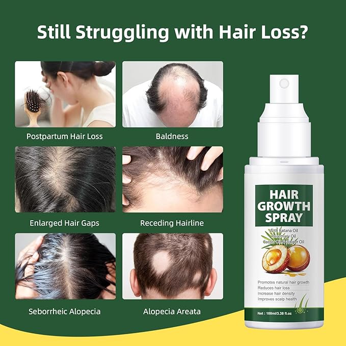 YAFUSIPE Hair Growth Oil Spray Batana Oil Dr Sebi Organic With Rosemary Castor Ginger, Natural Hair Loss Treatments for Women Men Promotes Regrowth Reduces Loss Thinning Strengthen Scalp Nourishes Dry