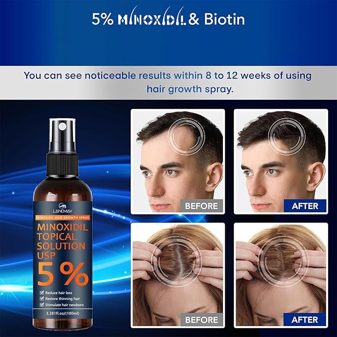 5% Minoxidil for Men & Women, Hair Beard Growth Spray with Biotin, Minoxidil Hair Growth Serum for Hair Regrowth, for Hair Loss & Thinning, make Hair Stronger Thicker -3.38 fl.oz /100ml