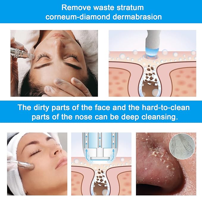 AIMENGXI Diamond Microdermabrasion Machine Professional Dermabrasion Machine Facial Care Salon Equipment for Vacuum Blackhead Removal