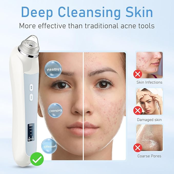 Heads Pore Cleaner Kit