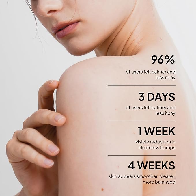 BellamiLuxx Fungal Acne Treatment Lotion: Effective Face & Body Pimple Cream for Bumps, Clusters, Itch & Redness – Fungal-Prone Skin Acne Treatment Moisturizer for Teens & Adults with Natural Actives