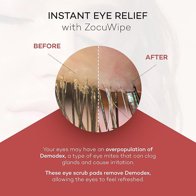Zocular Zocuwipe Eyelid Wipes, Gentle Cleansing & Moisturizing, 30 Count