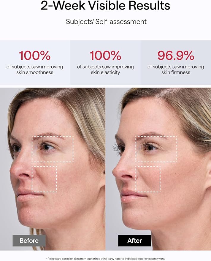 JMOON by Ulike Microcurrent Facial Device, M30U Red Light Therapy for Face, Safe Anti Aging Skin Care, 4 Modes, 5 Energy Levels for Full Face Lift and Ideal for Smile Lines, Eyes, and Forehead (Red)