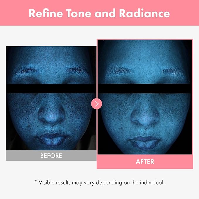 TOSOWOONG PDRN Hyaluron Face Cream for Hydrating & Firming, Dark Spots
