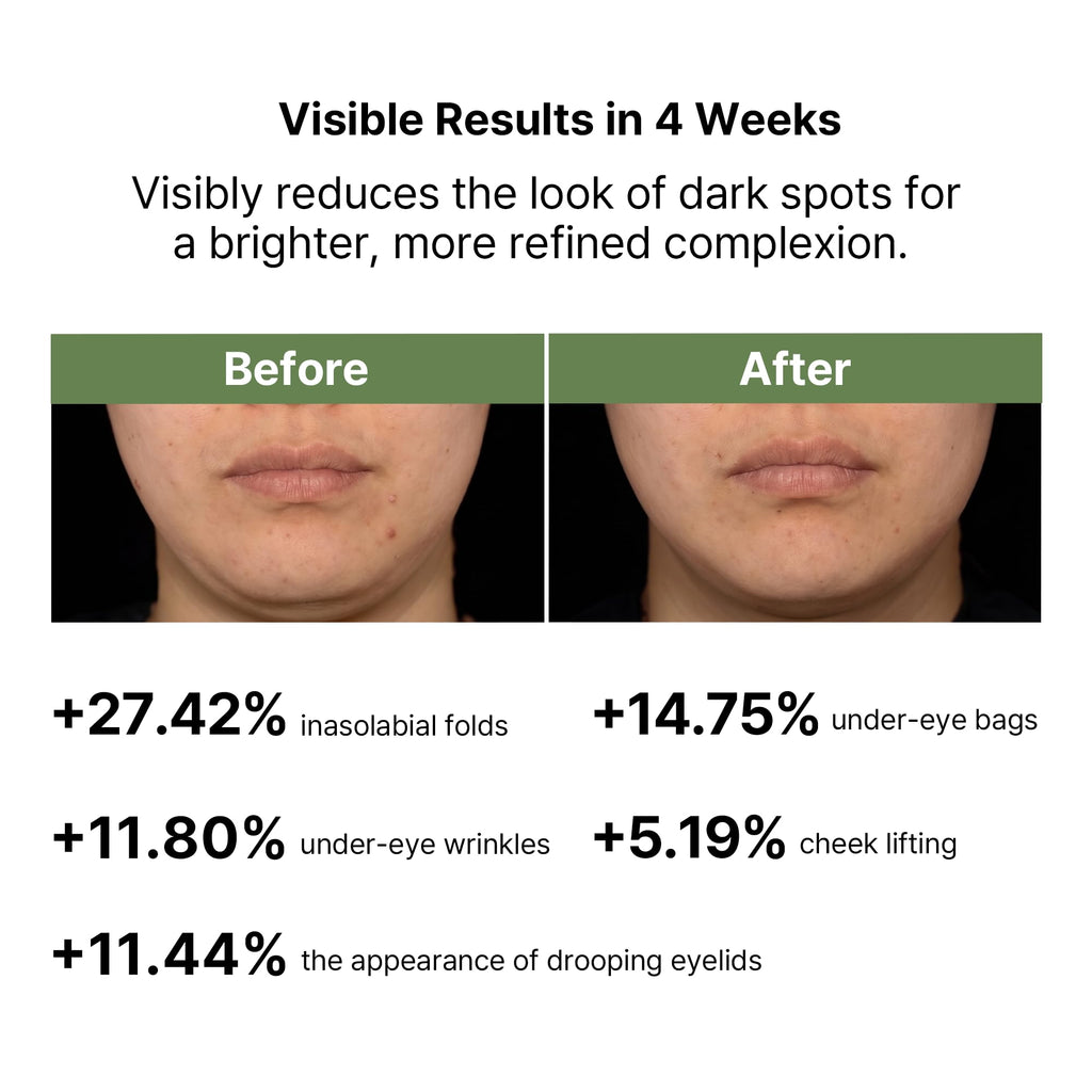 ClearDea Mucin Collagen Voluming Ampoule Moisturizer Face Cream (Dual Collagen + Mucin Care) – Deep Hydrating Facial Skin Care for Women, Glow Up Skincare Essentials - 0.14 Fl Oz x 5ea