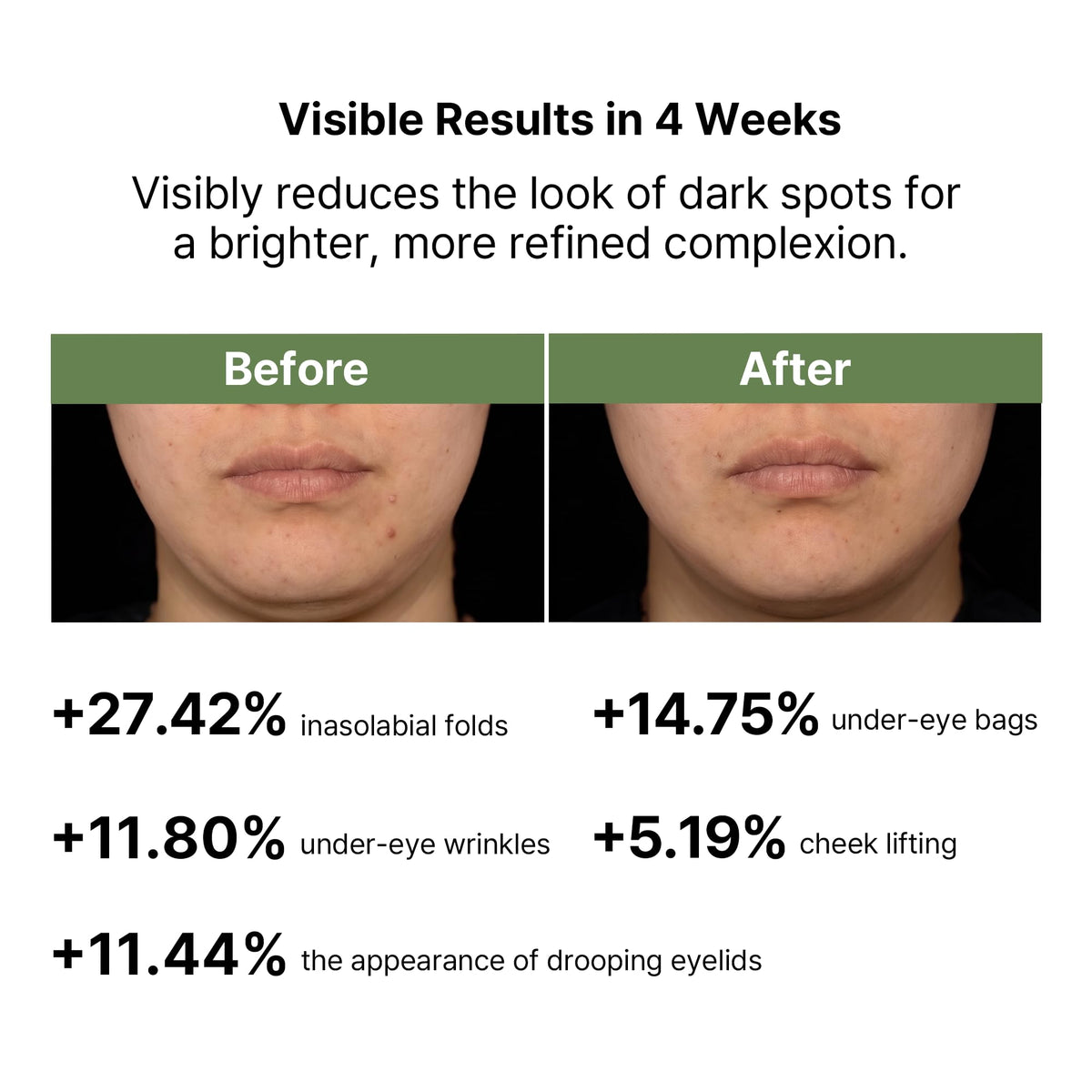ClearDea Mucin Collagen Voluming Ampoule Moisturizer Face Cream (Dual Collagen + Mucin Care) – Deep Hydrating Facial Skin Care for Women, Glow Up Skincare Essentials - 0.14 Fl Oz x 5ea