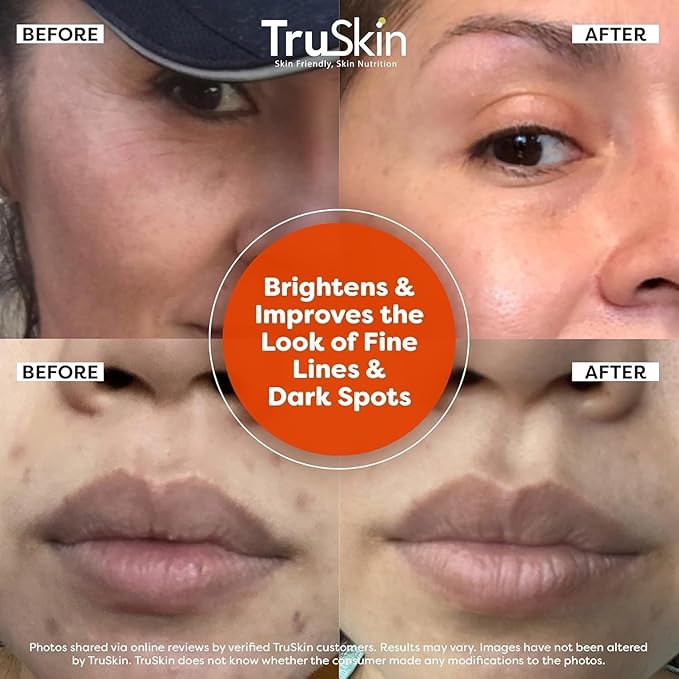 TruSkin Brightening Vitamin C Serum for Face with Hyaluronic Acid, 1 fl oz