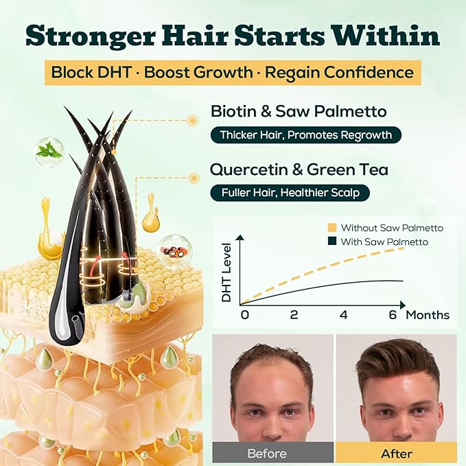 Saw Palmetto Gummies for Men – 600mg Extra Strength DHT Blocker with Biotin