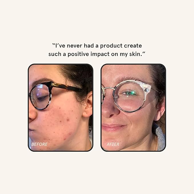 Barefaced Overachiever 1 Fl Oz – 10-in-1 Skin Booster with Bakuchiol, Resveratrol & Green Tea – Retinol Alternative, Hydrates, Minimizes Pores & Fine Lines