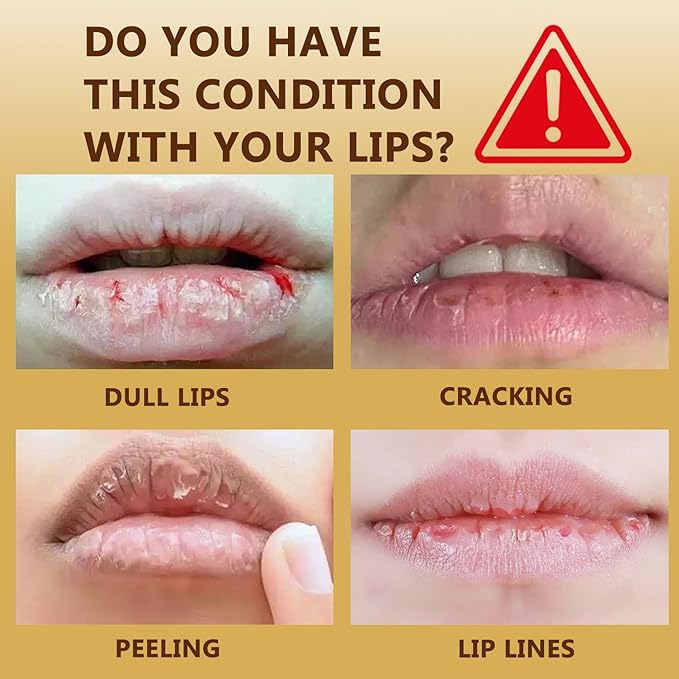 MOLAKS Transferproof Color Changing Lipstick with Gold Foil & 24H Moisturizing Glossy Shine – PH Reactive Long Lasting Mood Lipstick for Women, Deep Nourishment Lip Balm, Non-Fading Lip Gloss (1Pcs)
