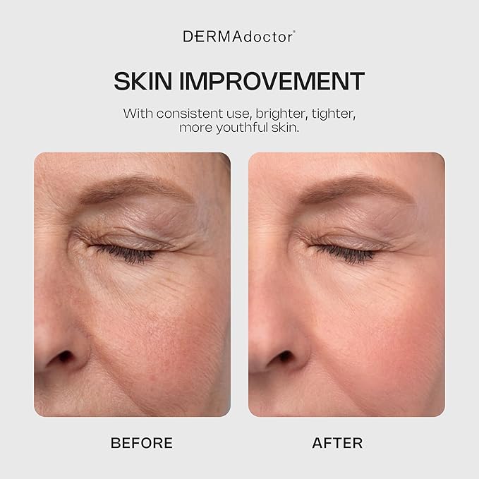 DERMAdoctor Glycolic Acid Face Wash for Fine Lines & Wrinkles, 7.1 oz