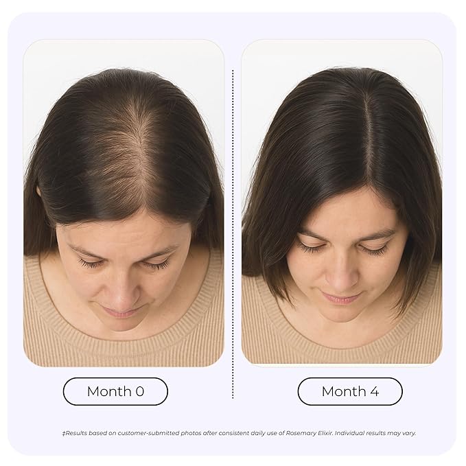 Growplex Rosemary Elixir – Daily Scalp Oil with 9 Essential Oils – Lightweight, Non-Greasy Formula for a Healthy-Looking Scalp – For Men & Women – 2oz