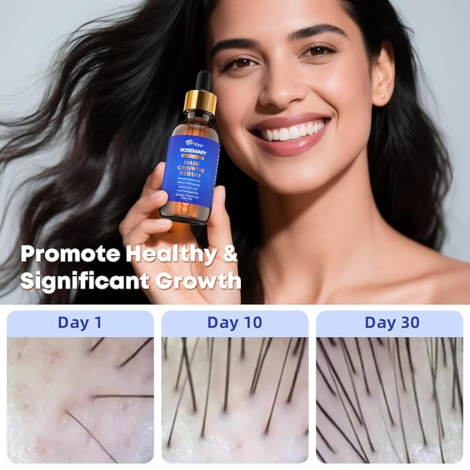100% Natural Hair Oil with Rosemary & Saw Palmetto, Nourishing Treatment for Dry Damaged Hair, Smooth Frizz & Strengthen Strands for Silky Soft Shine