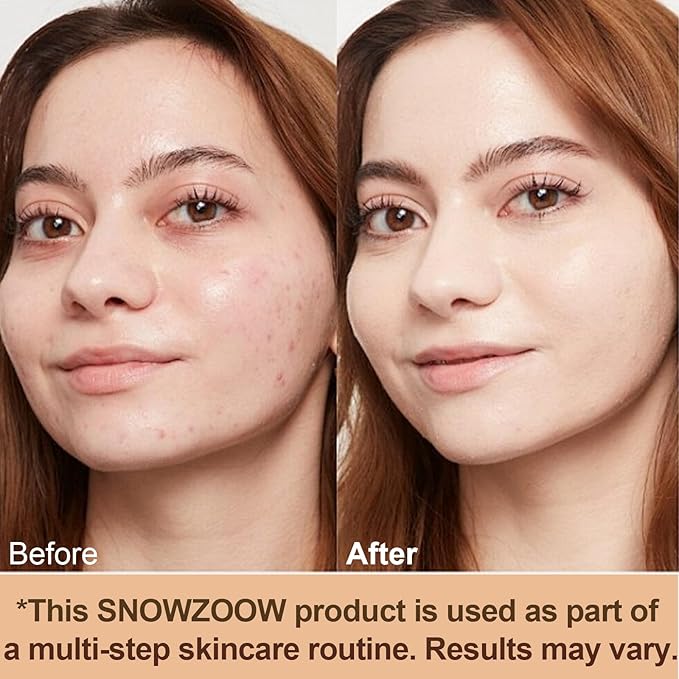 4 in 1 foundation Liquid- Hydrating Medium full coverage concealer -SPF 50+ -Longwearing & Waterproof-korean makeup (Light spectrum -Gold Lid- suitable for people with fair skin)