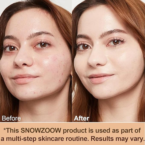 4 in 1 foundation Liquid- Hydrating Medium full coverage concealer -SPF 50+ -Longwearing & Waterproof-korean makeup (Light spectrum -Gold Lid- suitable for people with fair skin)