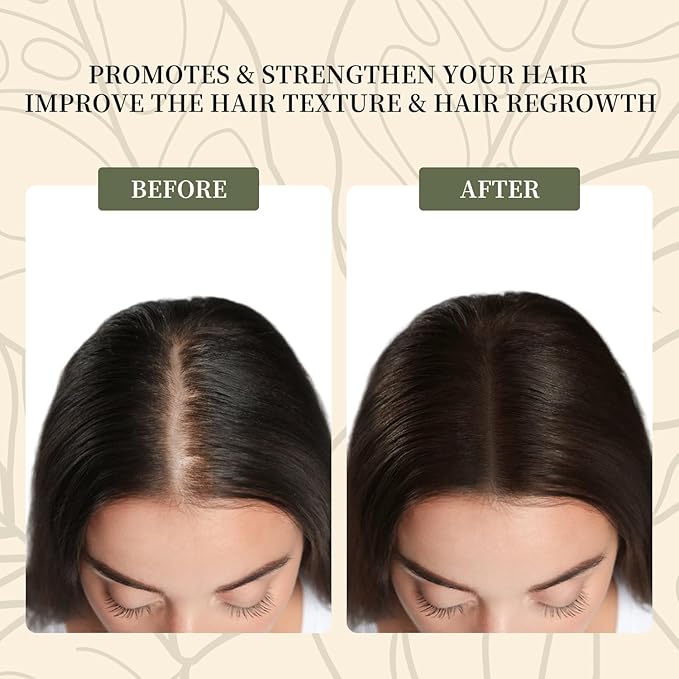 Vivccon Batana Oil for Hair Growth,100% Pure & Natural Raw Batana Oil, Dr. Sebi Organic from Honduras,Care for Hair Thickness,Scalp&Skin,4.23 fl oz,1 Bottle with 2 Caps