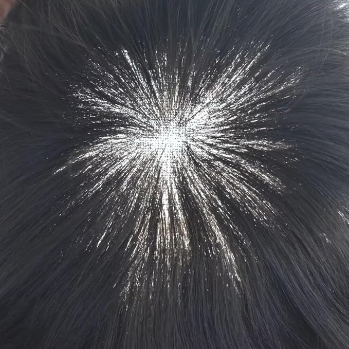 Toupee for Men French Lace Center Human Hair Replacement Systems Transparent Lace Center Hair Piece Mens Toupee Hair Units for Man V-Looped Front Male Hair Prosthesis 7"X10" #2 Darkest Brown