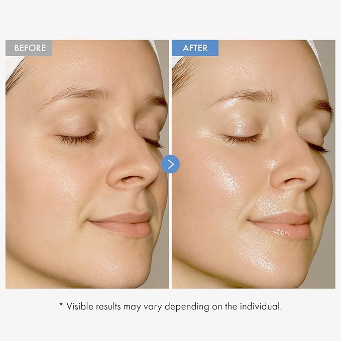 TOSOWOONG Hyaluronic Acid 9 Cream Daily Face Moisturizer for Hydration